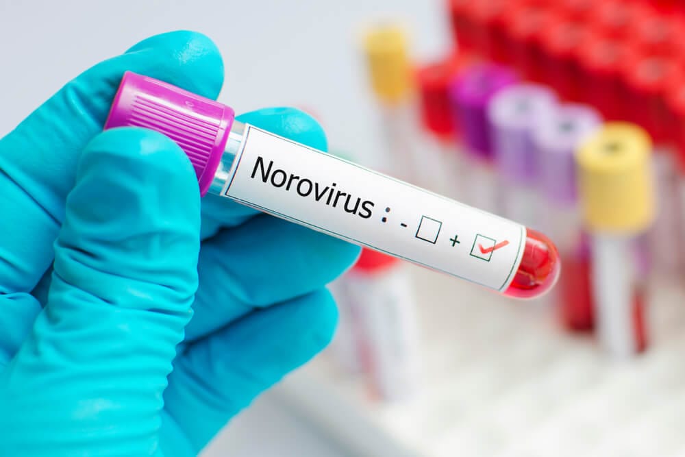 Is Vomit Considered a Biohazard?