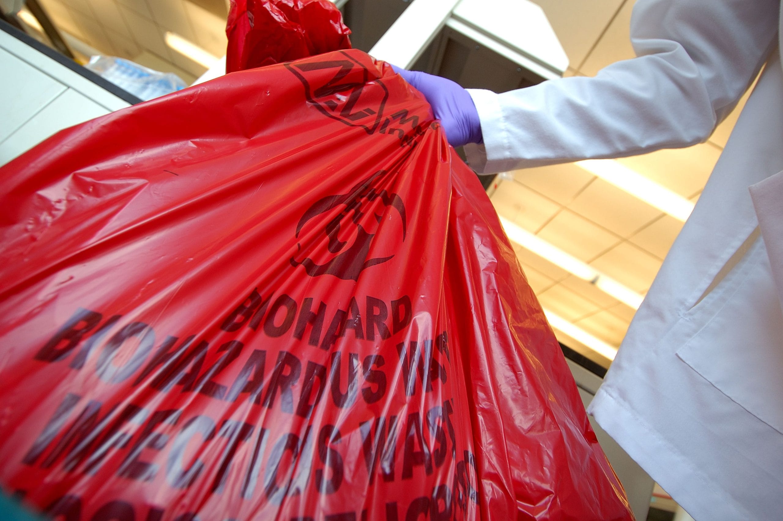 How to Clean Up Blood